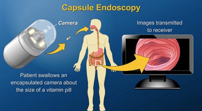 Heart Treatment in Gurgaon