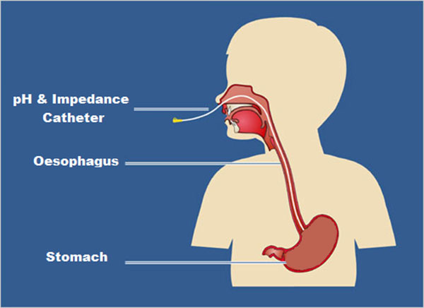 Heart Treatment in Gurgaon